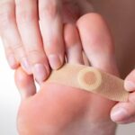  What The Wart? Types, and Treatments