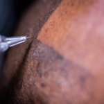 Scalp Micro Pigmentation: A Modern Solution to Hair Loss