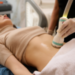 Non-Invasive Body Contouring: the Magic of Ulsculpt