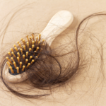 Managing Postpartum Hair Loss: Causes, Solutions, and Tips
