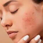 How Over-Exfoliating & Other Habits Damage Your Glow