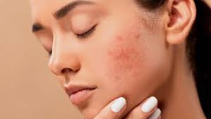 How Over-Exfoliating & Other Habits Damage Your Glow