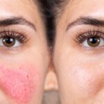 Skin Barrier Breakdown:       Are You Damaging Your   Glow Without Knowing?
