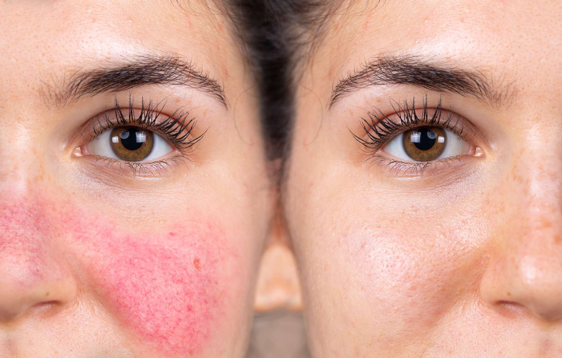 Skin Barrier Breakdown:       Are You Damaging Your   Glow Without Knowing?